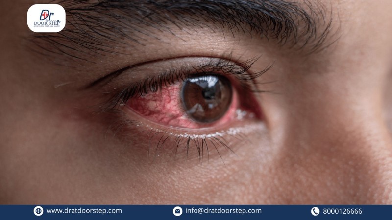 Popular Myths of Pink Eyes Busted (2)