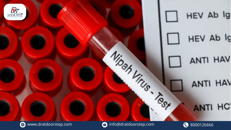 Causes, Symptoms And Treatment of Nipah Virus